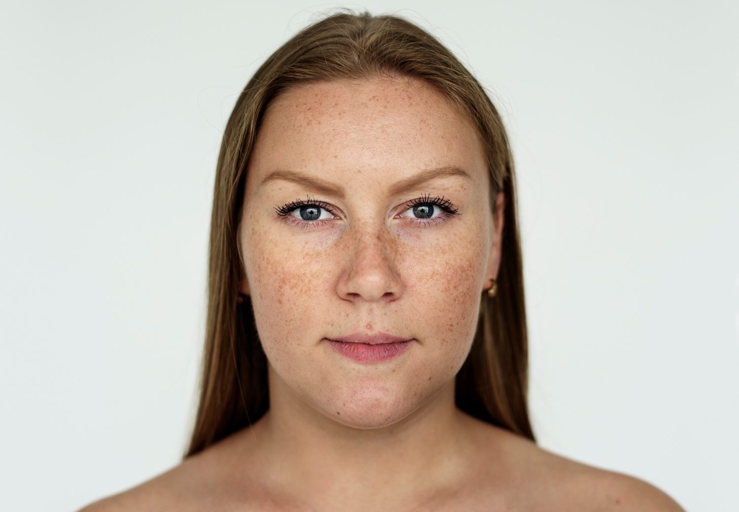 Brown Spots & Pigmentation at Evora